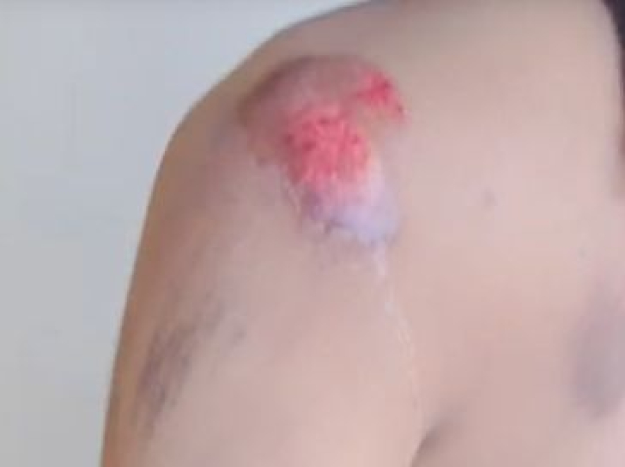 Jovem pula de moto por aplicativo após suspeitar de desvio de rota em Rio Largo