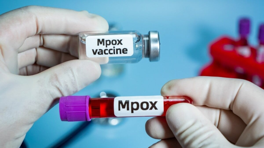 Brasil registra 88 casos de Mpox em 2026