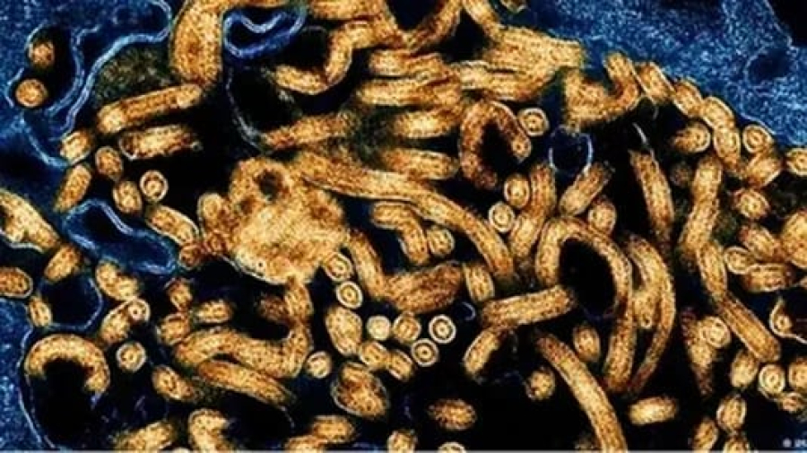 Secretaria de Saúde de São Paulo intensifica vigilância e protocolos contra risco de ebola no estado