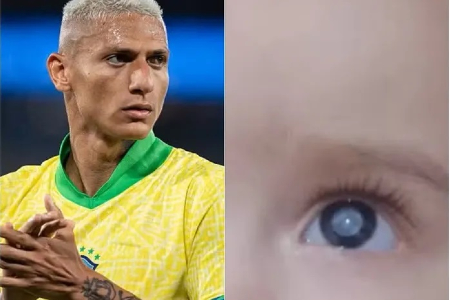 Richarlison doa R$ 60 mil para tratamento de criança com catarata congênita em Alagoas